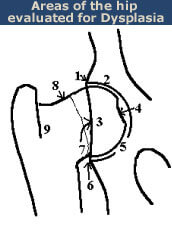 hip evaluation